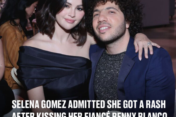 Selena Gomez admitted she got a rash after kissing her fiancé Benny Blanco for the first time